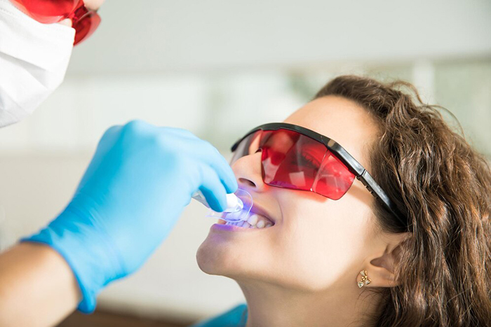 general-dentistry-img2
