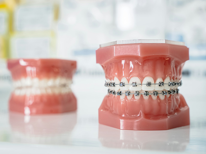 Orthodontics Orthodontics