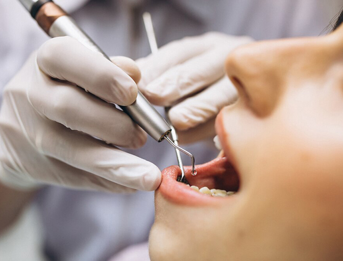 restorative-dentistry-img1