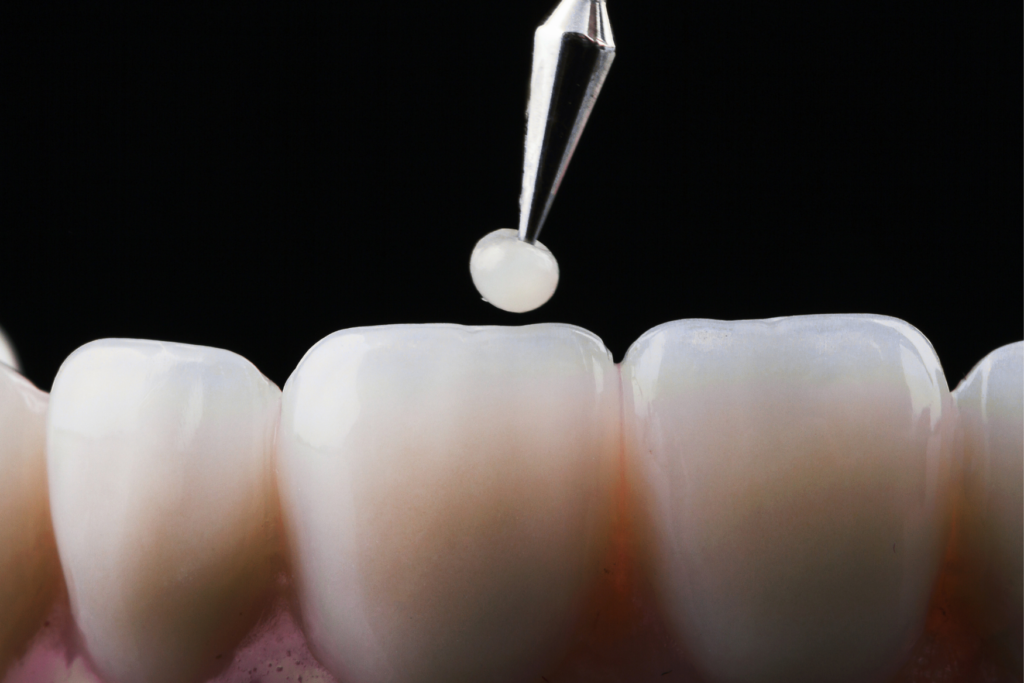 close up of teeth being restored